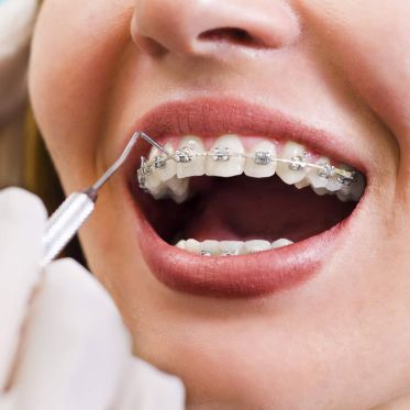 Orthodontics Berkshire
